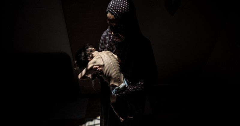 Gazze'de son 24 saatte 5 kişi daha açlıktan can verdi