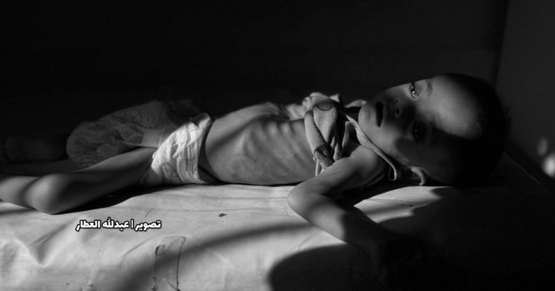 Gazze'de açlıktan can verenlerin sayısı 227'ye yükseldi