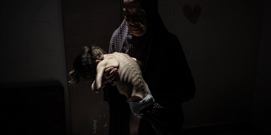 Gazze'de son 24 saatte 4 kişi daha açlıktan hayatını kaybetti