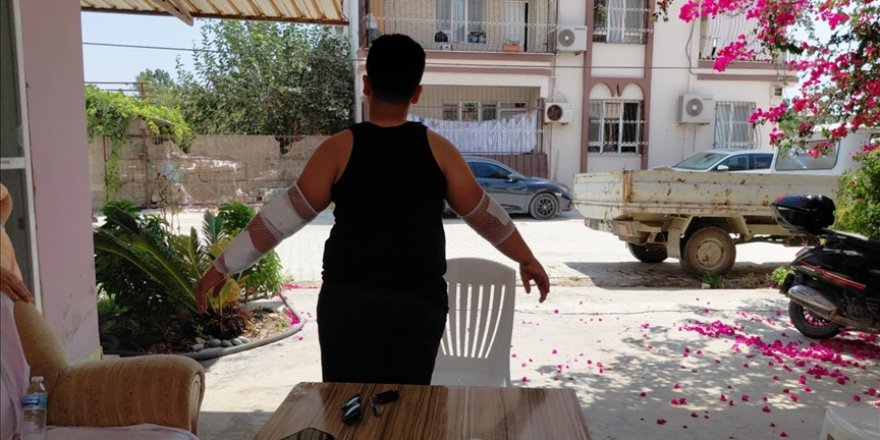 Hatay'da başıboş köpeklerin saldırdığı çocuk yaralandı