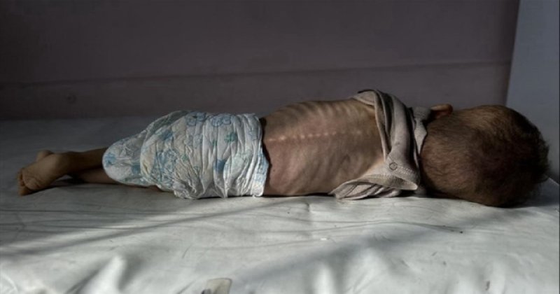 Açlığın anatomisi: "Çok acımasız ve yavaş bir ölüm"