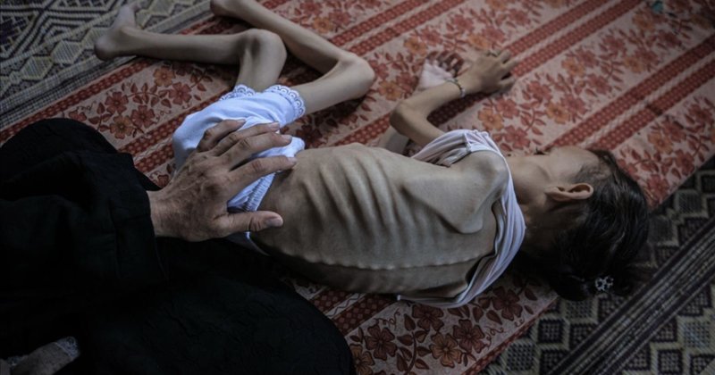 Gazze'de son 24 saatte 2'si çocuk 7 Filistinli daha açlıktan can verdi