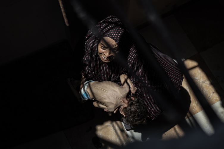 BM Gazze'de tam kıtlık hali ilan etti