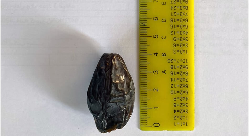 Gazze'deki hurmanın hikâyesi