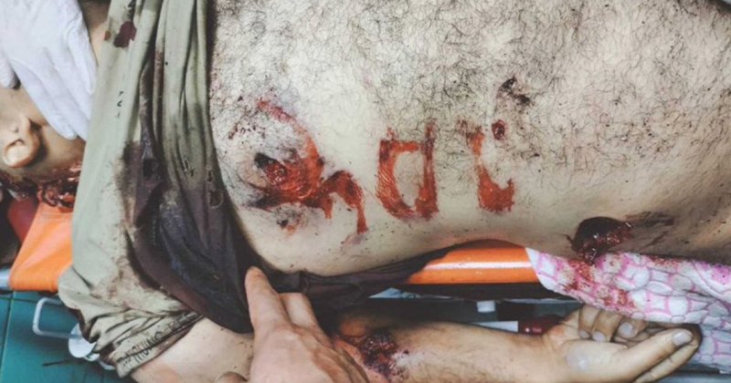 İşgal rejimi Filistinli şehidin naaşına zarar verdi