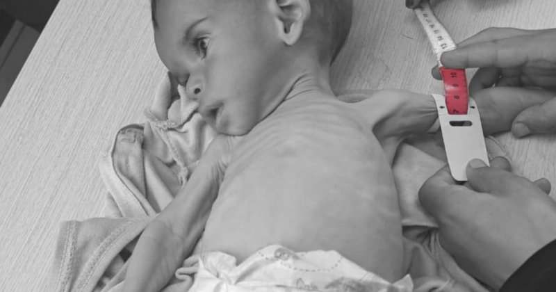 Gazze'de açlıktan can verenlerin sayısı 145'i çocuk 420'ye yükseldi