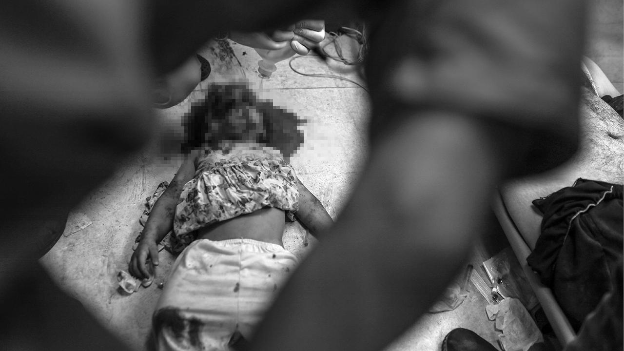 Gazze’de doktorlar ameliyatları anestezisiz yapıyor