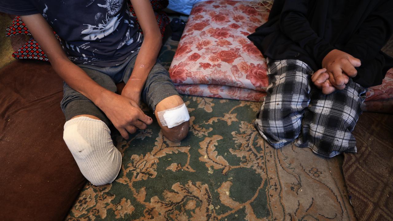 BM: 7 Ekim'den bu yana Gazze'de 4 bin çocuk ampute edildi