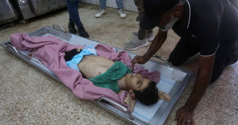 Gazze’de açlıktan can verenlerin sayısı 455’e yükseldi