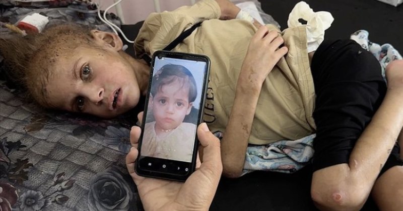 Gazze’de açlıktan 12 kiloya düşen May artık yürüyemiyor