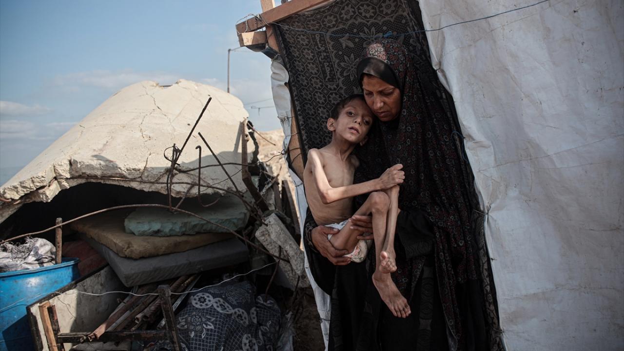 Gazze’de açlıktan ölenlerin sayısı 457 oldu