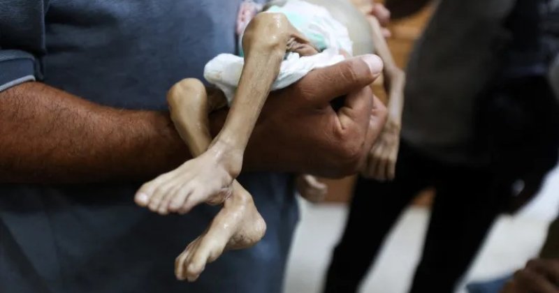 UNICEF: Gazze’de 20 bin çocuğun öldürülmesine dünyanın sessiz kalmasını hayretle karşılıyoruz