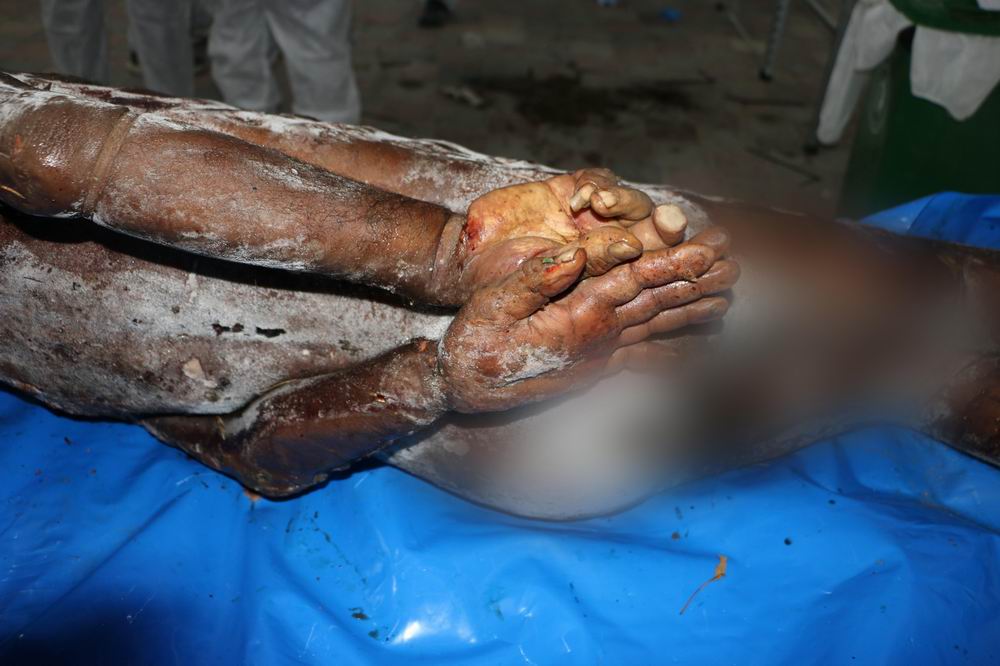 Katil İsrail, 195 cesedi Gazze'ye iade etti; çoğu elleri bağlı ve işkence izleri taşıyan cesetlerdi (Foto – Belge)