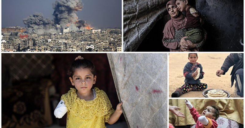 Siyonist saldırılarda binlerce çocuk ampute edildi