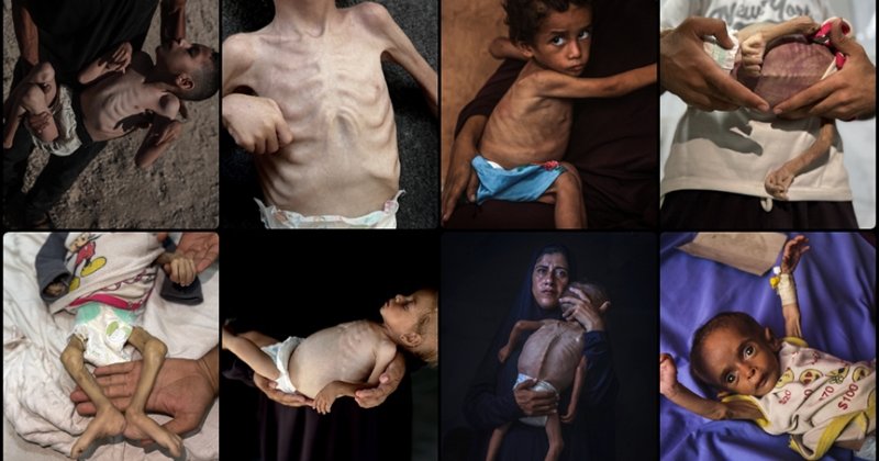 Gazze'de açlığın anatomisi ve genetik mirası