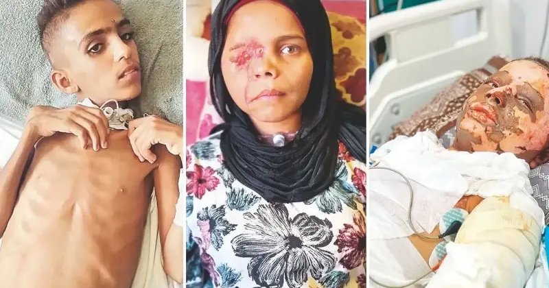 Gazzeli çocuklar tedavi bekliyor