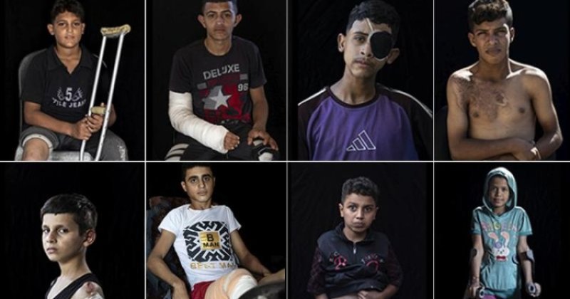 Gazze'de 5 bini aşkın çocuk ampute edildi