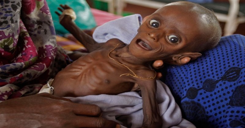 Dünya Bankası: Yemen kıtlığın eşiğinde