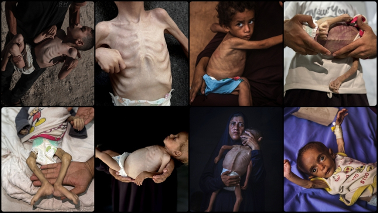 Batı’ya göre Gazze’de hayat hiyerarşisi: Eşekler çıktı, çocuklar kaldı