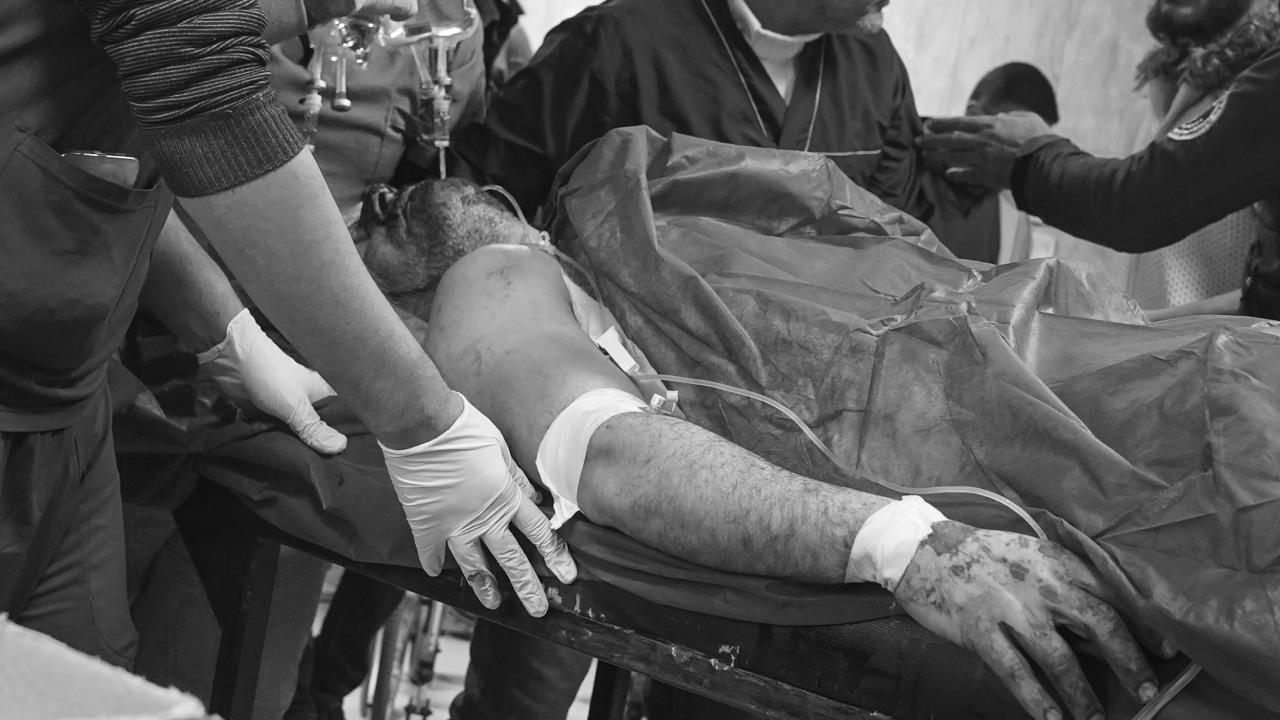 PKK/YPG'nin Halep'teki saldırılarında 7 kişi öldü, 52 kişi yaralandı