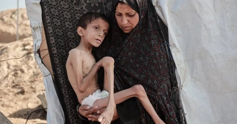 Gazze'de akut yetersiz beslenme vakaları 95 bine dayandı