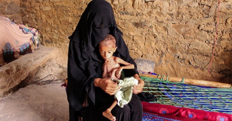 BM uyarısı: Yemen’de açlık tehlikesi büyüyor