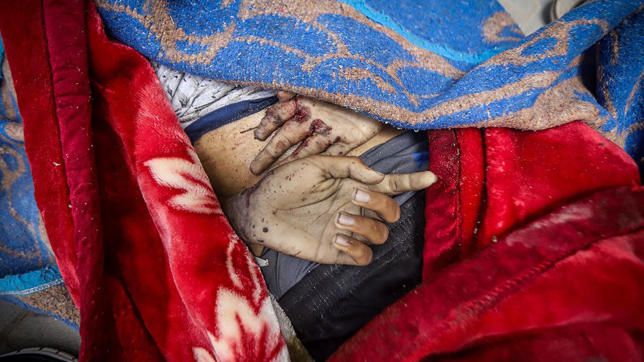 Lancet: Gazze'de can kaybı bildirilenden çok daha yüksek