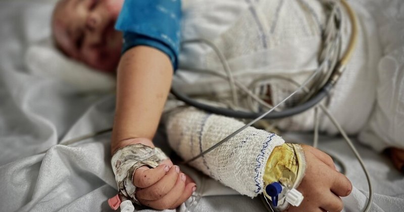 Gazze'de yanık hastaları için gerekli tıbbi malzemeler tükenmek üzere