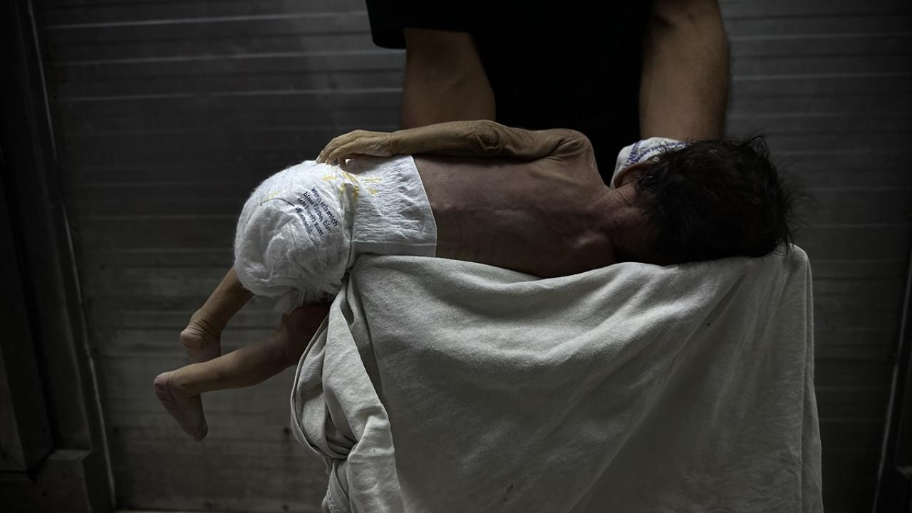 Gazze'de bebek ölümleri ve doğum kusurları artıyor