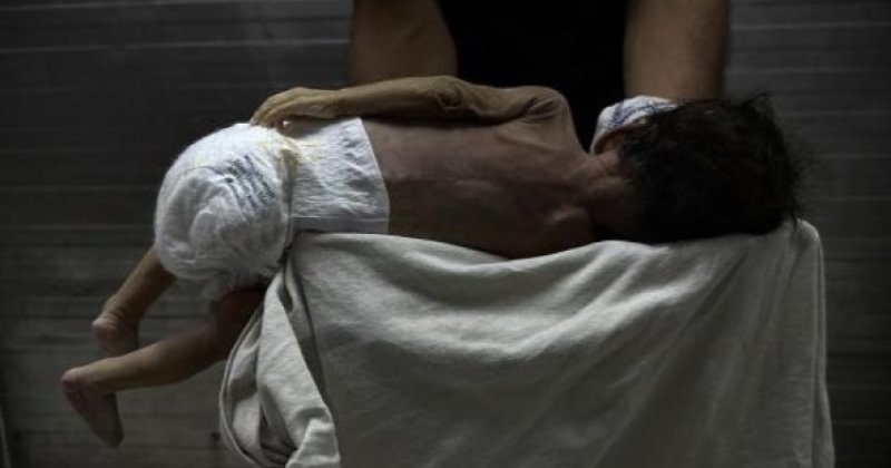 Gazze'de savaşın gölgesinde bebek ölümleri ve doğum kusurları artıyor