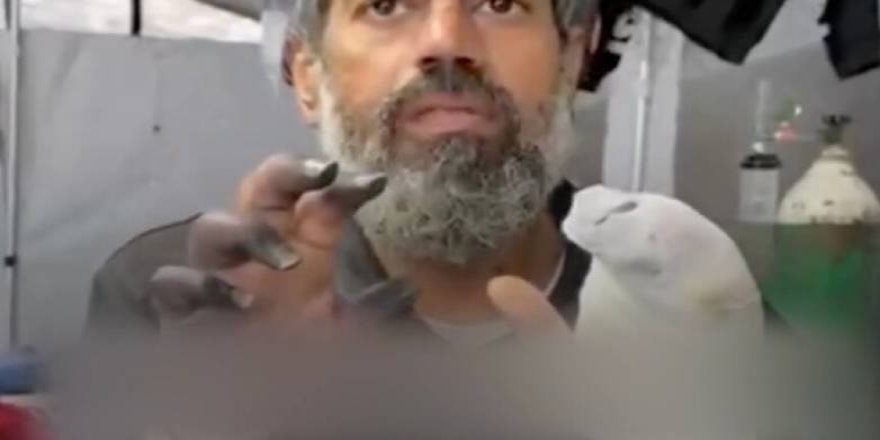 Parmaklarını bir bir kaybeden Gazzeli hasta İsrail'in kısıtlamaları nedeniyle çaresizce tedavi olmayı bekliyor