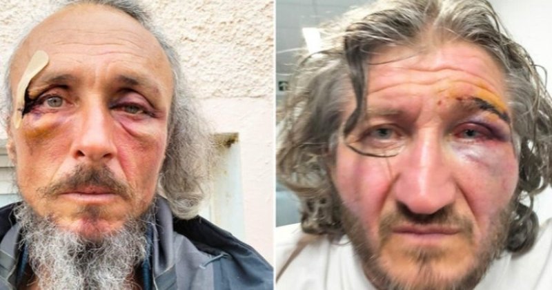 Katil İsrail'in Küresel Sumud Filosu'na saldırısında 31 aktivist yaralandı