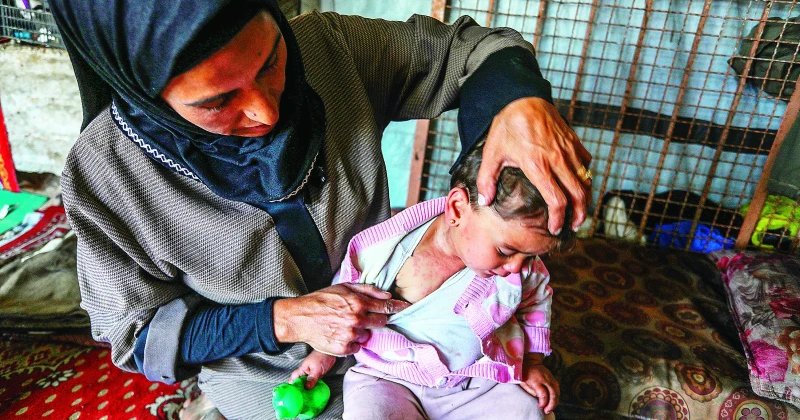 Gazze'de cilt hastalıkları hızla yayılıyor