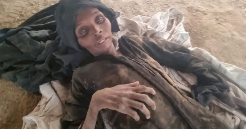 Unutulan Yemen'de insanlar açlıktan ölüyor