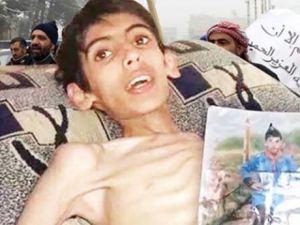 Madaya’dan Kaçış Yok; Açlık Var, Ölüm Var!