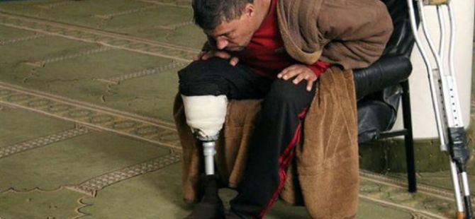 Bacağını Kaybetti Ama Camisinden Vazgeçmedi