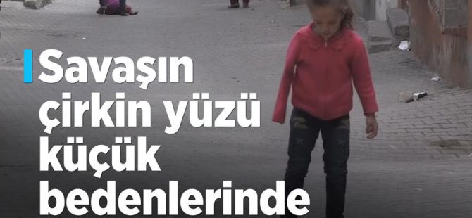 Savaşın Çirkin Yüzü Küçük Bedenlerinde