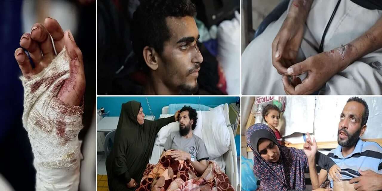Gazze’deki tutuklular İsrail Hapishanelerindeki işkenceyi anlatıyor