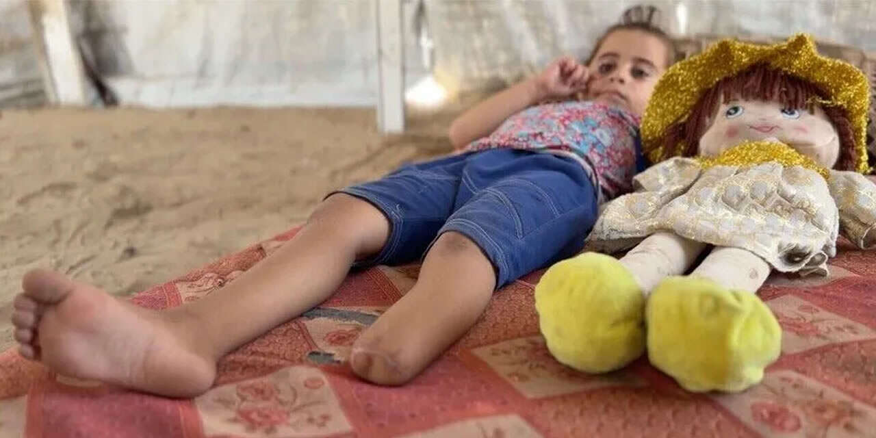 Katillerin saldırısında Filistinli küçük kız, kopan bacağını fotoğraflarda arıyor