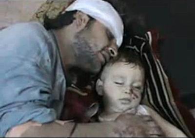 Suriyede Her Gün Bir İnsanlık Suçu