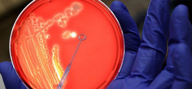 Endonezya'da 27 Kişide Şarbon Tespit Edildi