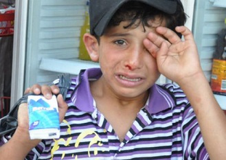 İzmir'de Mendil Satan Suriyeli Çocuğa Linç