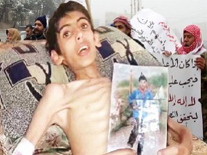 Hizbullah'ın Mayınlı Kuşatması Madaya Halkını Öldürüyor