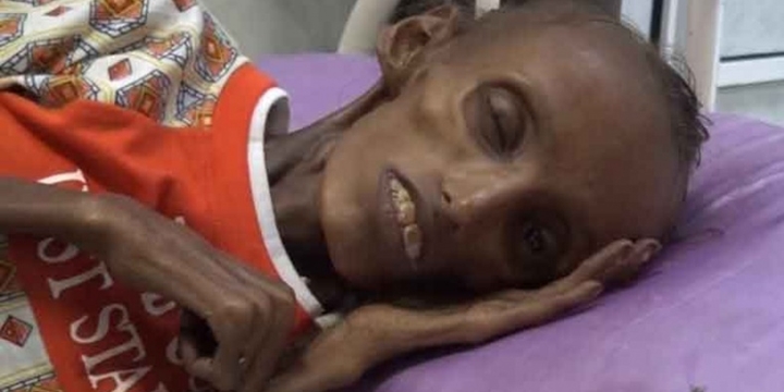 “Yemen’de Gerçekten Korkunç Bir Durum Var”