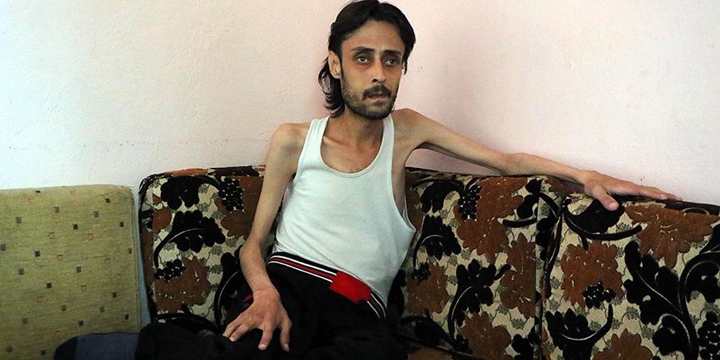 “Kuşatma Altındaki Halep’te Durum Çok Kötü”