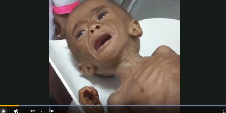 Yemen'in Yarısı Yiyecek Sıkıntısı Çekiyor