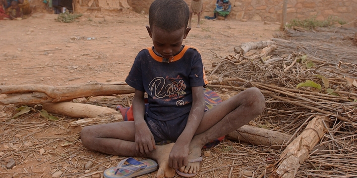 “Somali Yarımadası’ndaki Açlık Krizi Devasa Boyutlarda”