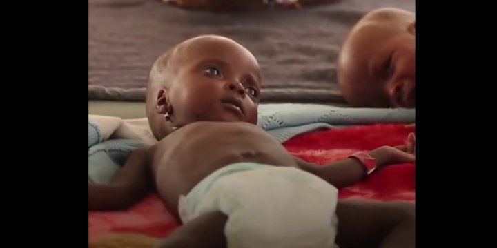 Nijerya’da Günde 2 Bin 300 Çocuk Açlıktan Ölüyor