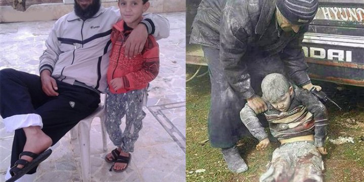 Suriye’de Bacakları Kopan Çocuğa İHH Sahip Çıktı