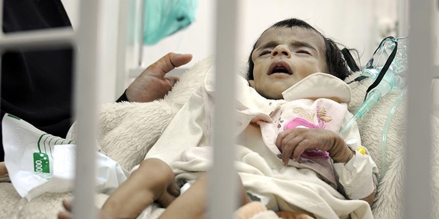 “Yemen’de Yarım Milyon Çocuk Ölüm Tehlikesiyle Karşı Karşıya”